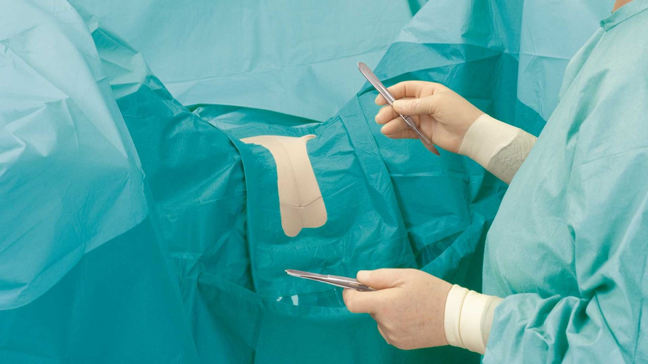 chirurgas, naudojantis „BARRIER“ ginekologinį apklotą operacijų metu