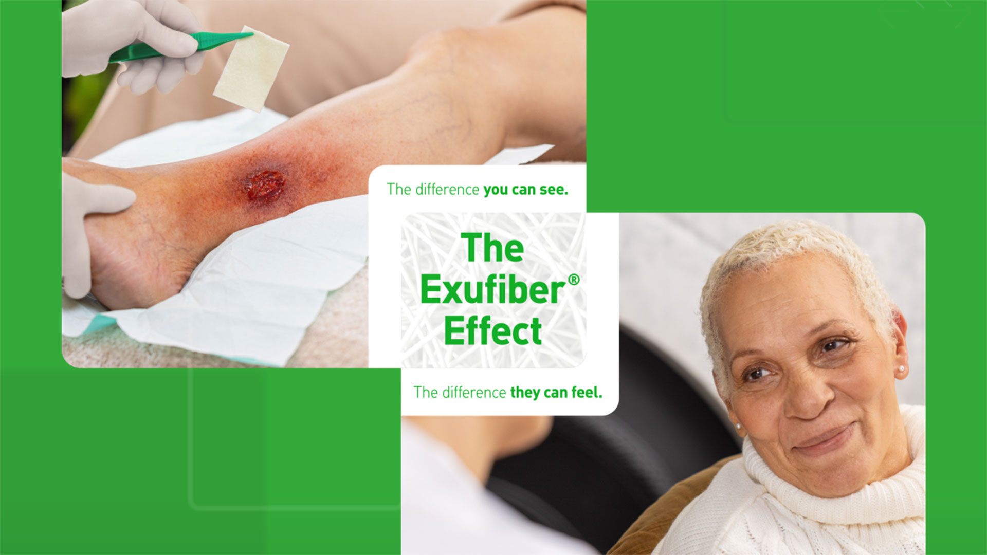 The exufiber effect 
